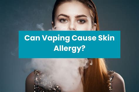 Can Vaping Cause Skin Allergy