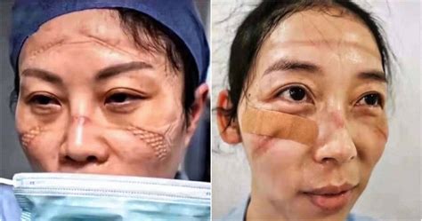 Disponible después de su transmisión en vivo si deseas ser el primer@ en verlo, acepta las notificaciones de nuestro sitio web. Mascarillas han marcado las caras de enfermeras chinas que ...