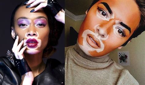 Model Winnie Harlow Is Not Offended By People Recreating Her Vitiligo