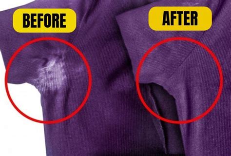 How To Remove Deodorant Stains From Armpits Of Shirts Remove