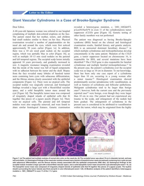 Pdf Giant Vascular Cylindroma In A Case Of Brooke Spiegler Syndrome