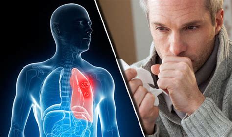 Lung Cancer Coughing More Lung Cancer Symptoms Coughing Up Red Or Pink