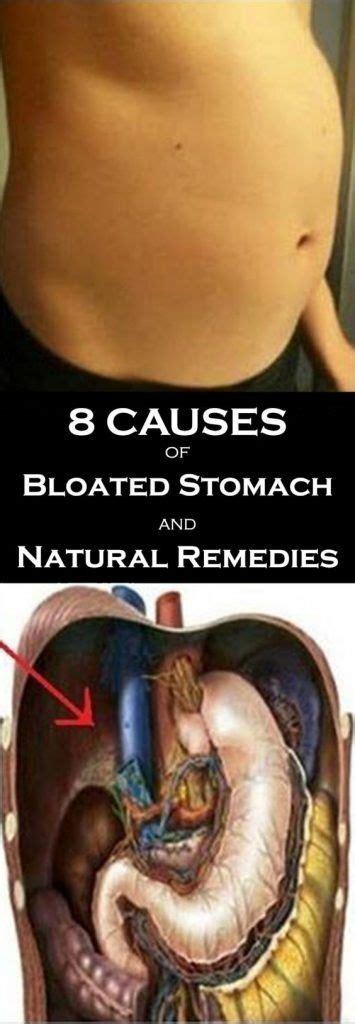 8 Causes Of Bloated Stomach And Natural Remedies Bloated Stomach