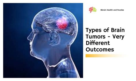 Types Of Brain Tumors Very Different Outcomes Brain Health And Puzzles
