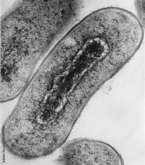 Cross Section Of Escherichia Coli Bacteria Under Transmission Electron