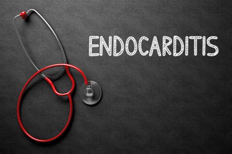 What Is Endocarditis Symptoms And Treatment Pulse Cardiology