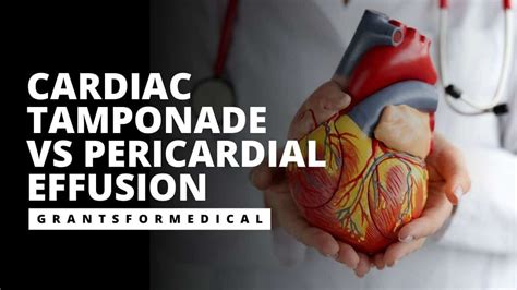 Cardiac Tamponade Vs Pericardial Effusion Free Download Nude Photo Gallery