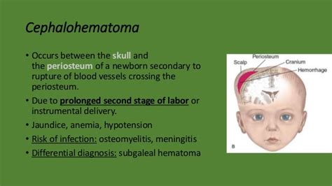 Types Of Hematomas In Newborns Peter Brown Bruidstaart