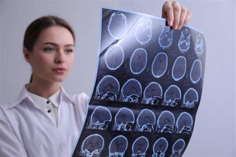 Care Sunt Simptomele Unei Tumori Pe Creier