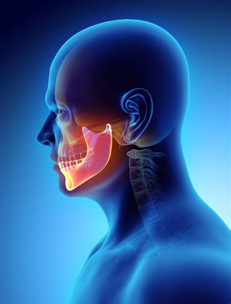 Dental Cavitation And Jawbone Infection Aria Dental