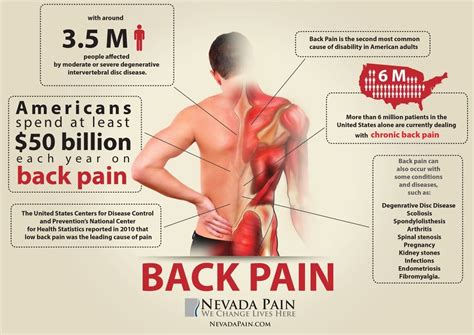 As such, each dermatome transmits sensory details from a particular area of skin back to your brain. Back Pain Infographic | Back Pain - Around 3.5 million ...