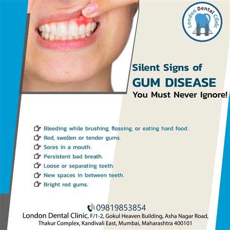 Silent Signs Of Gum Disease You Must Never Ignore Gum Disease
