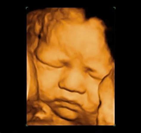 3d Ultrasounds Reno And Womens Health Services Gynecology Reno