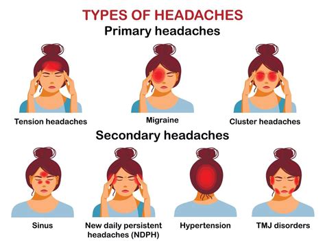 tipos de dores de cabeça infográfico vetorial 6781045 vetor no vecteezy