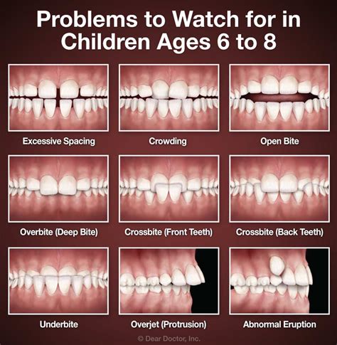 When To See An Orthodontist Discover Orthodontics Brampton Ontario