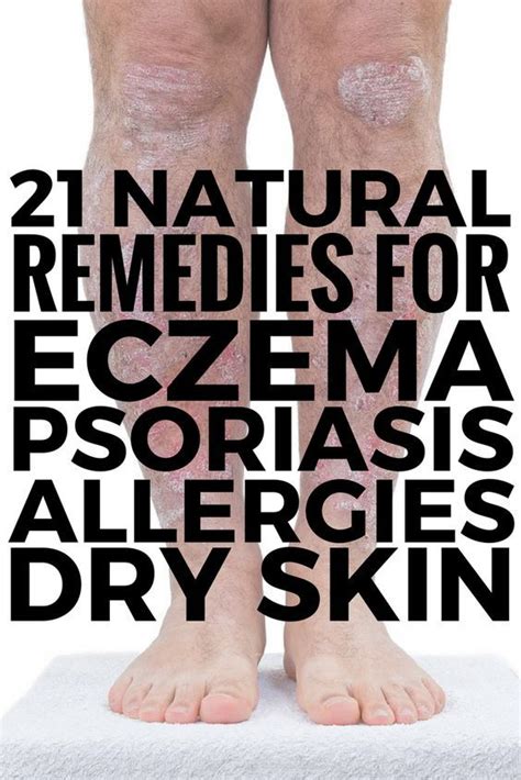 21 Itchy Skin Remedies That Work If Youre Looking For Itch Relief