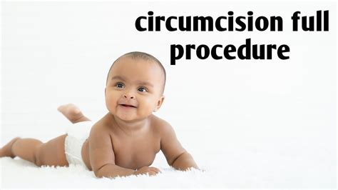 How To Do Classical Circumcisioncircumcision Procedurecircumciseddorsal Slit Circumcisionzsr