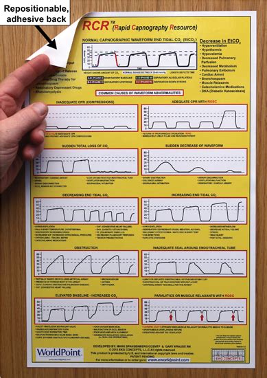 Normal And Abnormal Capnography Waveforms Infographic Capnoacademy My Xxx Hot Girl