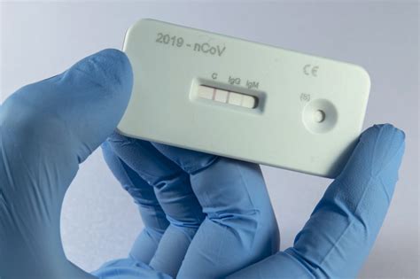 Was That COVID-19? Antibody Tests Promise Answers But ...
