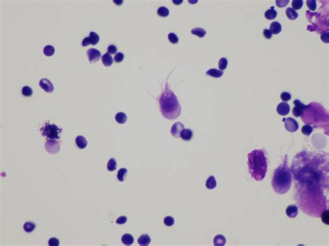 Filegiardia Lamblia Cytology Wikimedia Commons