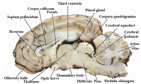 Labeled Diagram Of Brain Sagittal Sheep Brain Labeled Wwwtopsimages