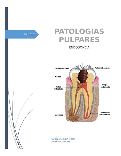 Patologias Pulpares 2 4 Karen Sisniega Ortiz C Gerardo Narvaez