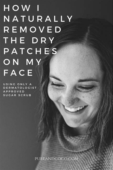 How To Treat Dry Patches On Your Face Using A Dermatologist Approved S