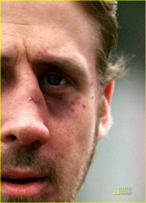 Ryan Gosling Gets A Black Eye Photo 1906921 Ryan Gosling Photos Just Jared Entertainment News