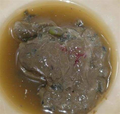 Eine der typischen hämorrhoidensymptome ist blut im stuhl. 20 Der Besten Ideen Für Blut Im Stuhl - Beste Wohnkultur ...