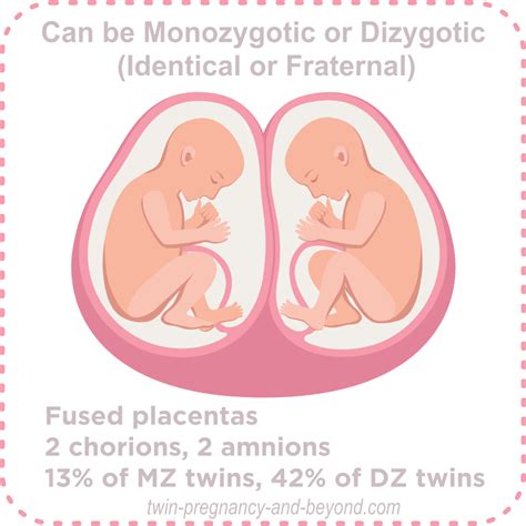 What Is Twin Zygosity Understanding Different Types Of Twinning