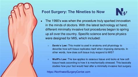 The History Of Minimally Invasive Foot Surgery