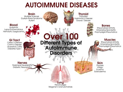 Diseases in different parts of the body. Information about autoimmune disorders