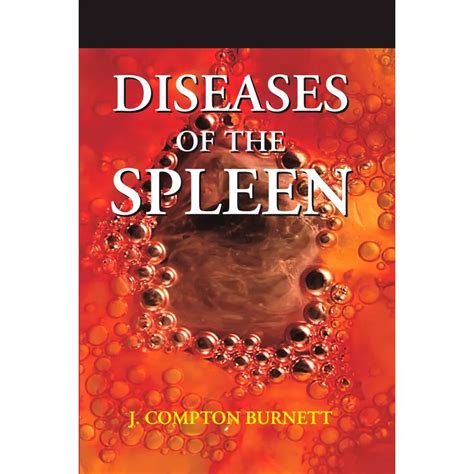 Buy Diseases Of The Spleen And Their Remedies Clinically Illustrated