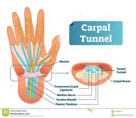 Superficial and deep anterior muscles of upper body. Carpal Tunnel Vector Illustration Scheme. Medical Labeled ...