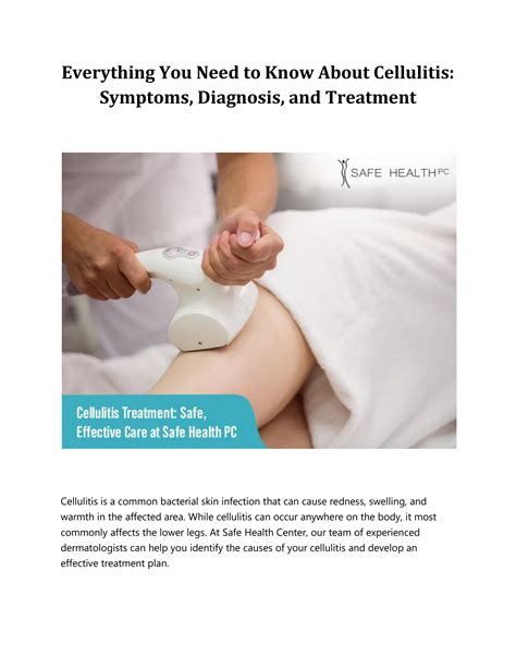 Everything You Need To Know About Cellulitis Symptoms Diagnosis And Treatment By Safe Med Spa