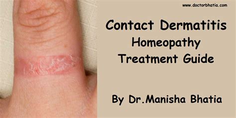 Contact Dermatitis Homeopathy Treatment And Homeopathic Remedies