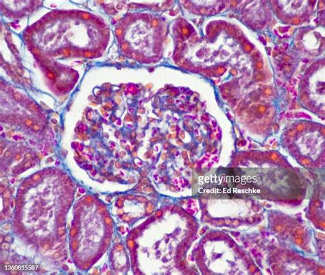 Glomerulus Kidney Photos And Premium High Res Pictures Getty Images