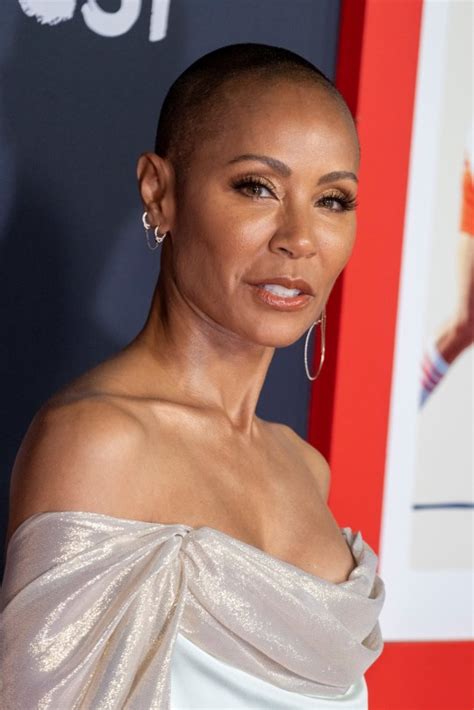 Jada Pinkett Smith Praised For Embracing Alopecia With Bald Spot Reveal