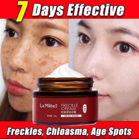 Dark Spot Corrector Cream Whitening Freckle Cream Powerful Removing