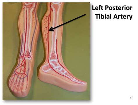 Left Posterior Tibial Artery The Anatomy Of The Arteries Flickr
