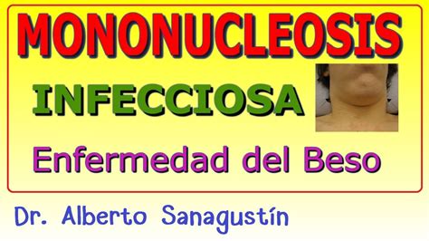Mononucleosis Infecciosa Enfermedad Del Beso Youtube