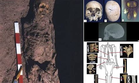Ancient Egyptian Skeletons With Signs Of Cancer Found Daily Mail Online