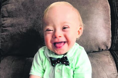 This extra chromosome results in small stature and low muscle tone, among other down syndrome is not an illness. Down syndrome toddler named new face of baby food maker ...
