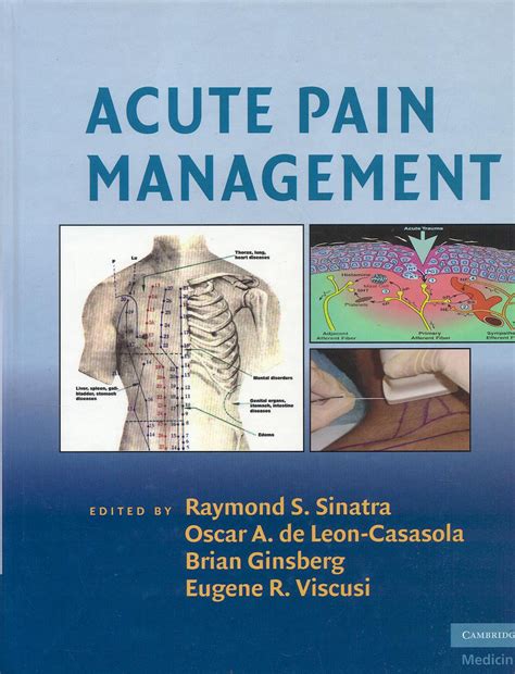 Acute Pain Management 9780521874915 Sinatra Raymond — Leon Casasola