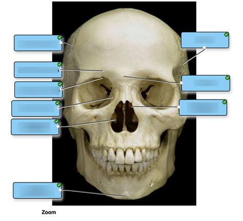 Bony Features Of Anterior Skull Diagram Quizlet