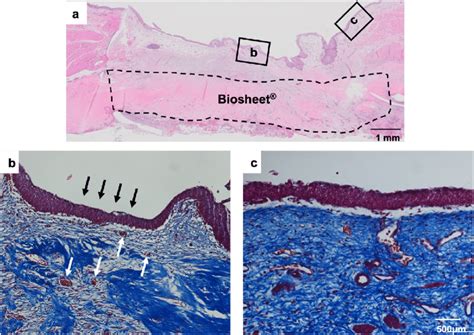 Histology Of Biosheet® At 4 Weeks After Implantation A Download