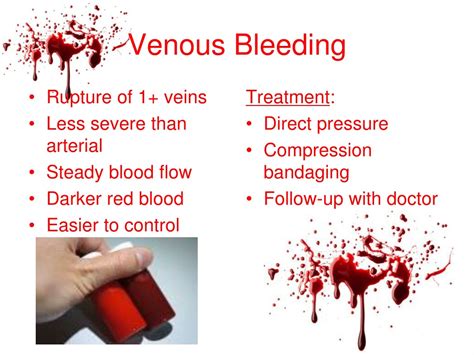 Ppt Bleeding And Shock Powerpoint Presentation Free Download Id482837