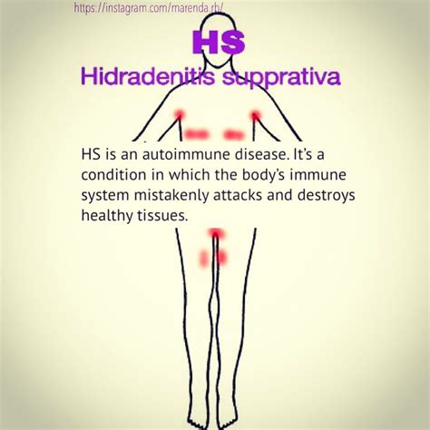 Hidradenitissupprativa Skindisorder Chronicillness Autoimmune