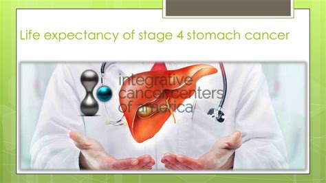 Stage 4 Colon Cancer Life Expectancy Chart