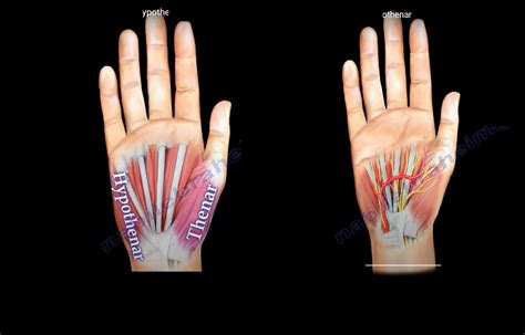 Thenar And Hypothenar Muscles Of The Hand —